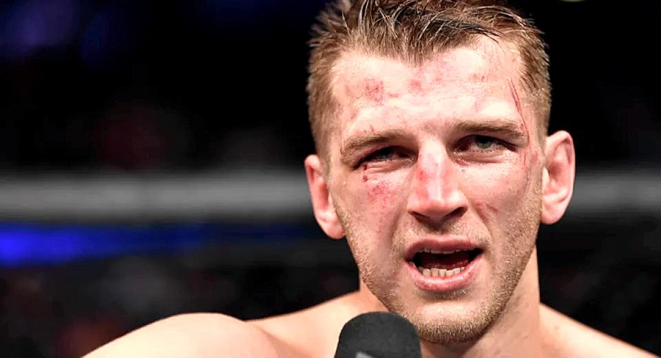 Dan Hooker details hand injury that forced him out of UFC 313